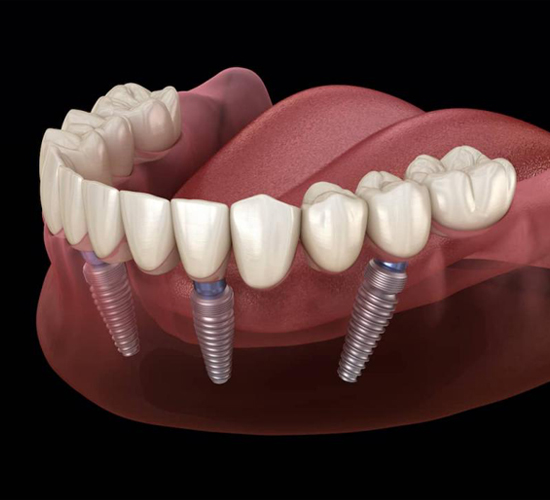 Best Dental Clinic in Aluva, Kerala Best Dentist Radiant Smile